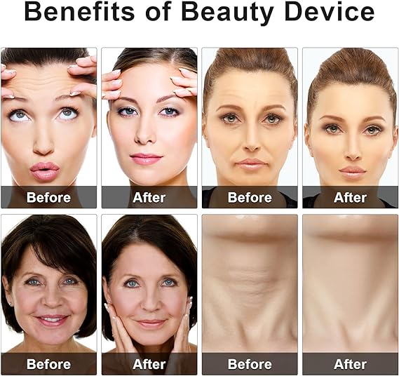 Eye Beauty Device | جهاز العناية بالعين