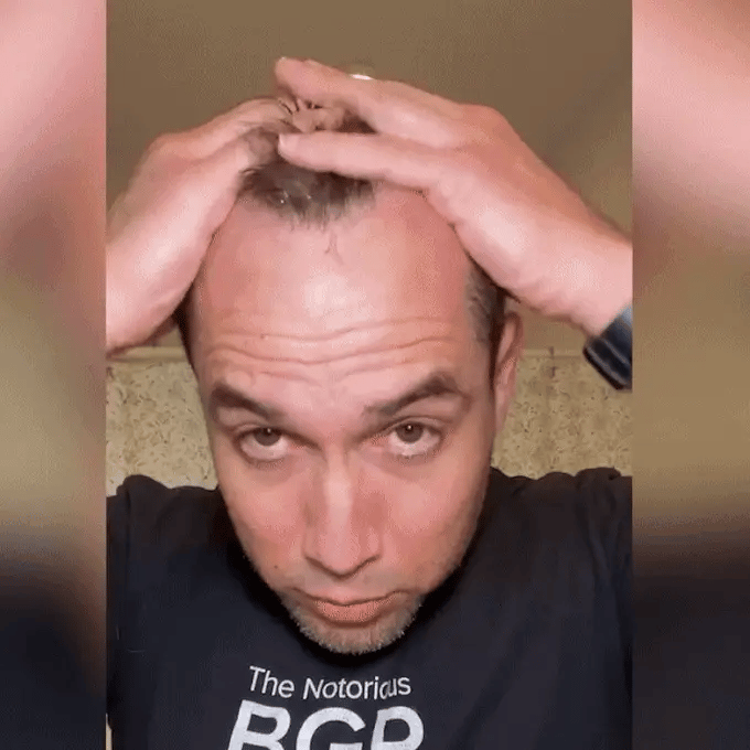 Hair Growth Spray | بخاخ نمو الشعر